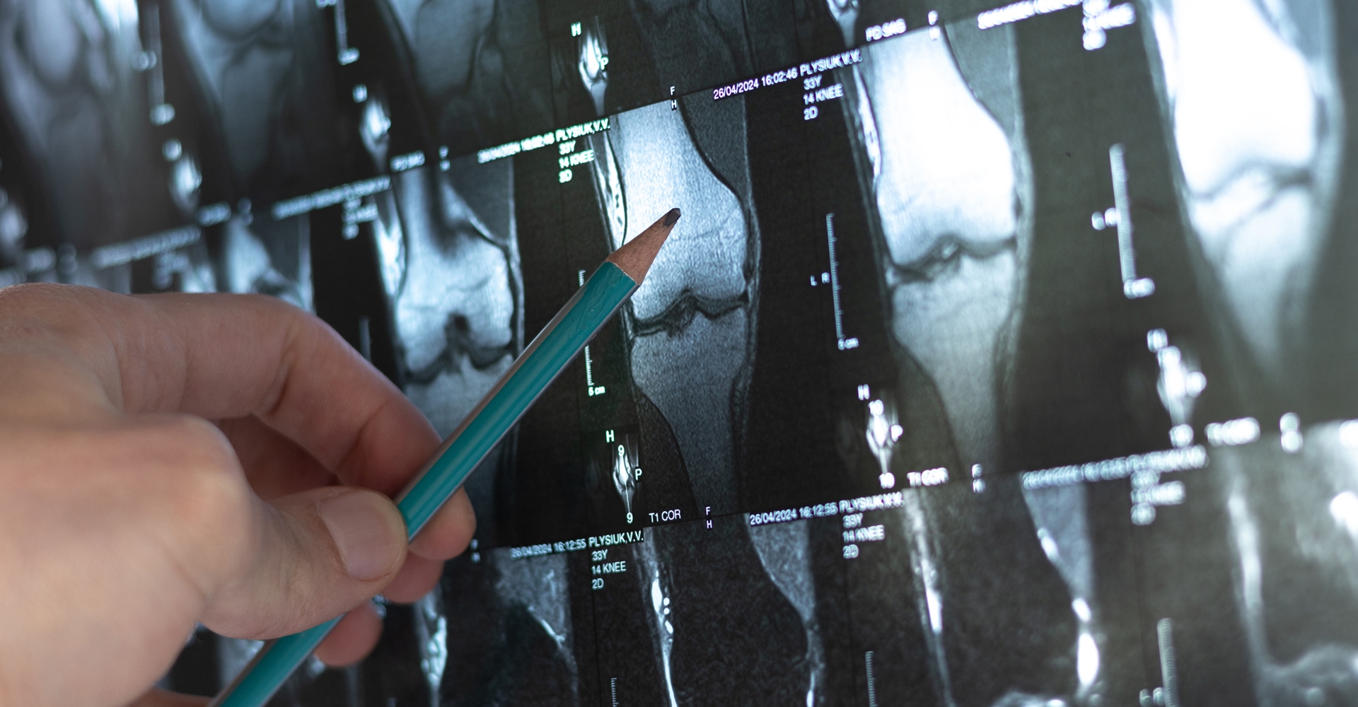 Orthopädiezentrum Wels Dr. Christoph Charwat-Pessler